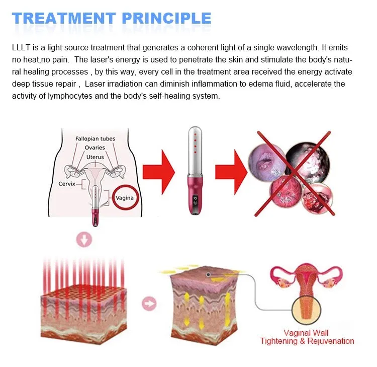 Clinicians Choice- LED Light and Vibration Vaginal Rejuvenation and Tightening Wand